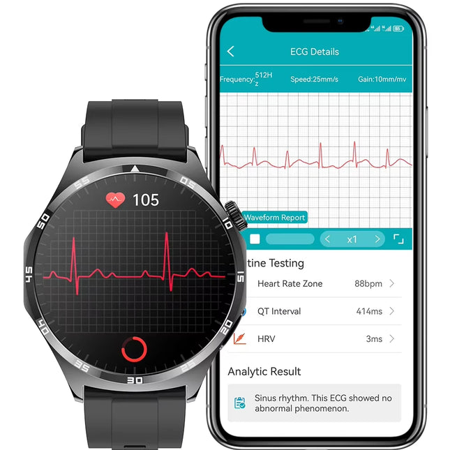 Wonlex MF13 ECG Health Smart Watch IP67 Waterproof Blood Pressure &  Blood Oxygen Monitoring 1.43 Inch AMOLED Screen Smartwatch