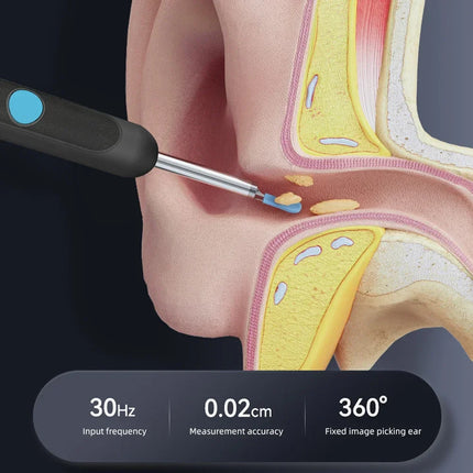 Smart Visual Ear Sticks Otoscope Endoscope Wax Removal Tool Earpick Mini Camera Health Care Ear Cleaner