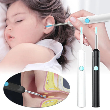 Smart Visual Ear Sticks Otoscope Endoscope Wax Removal Tool Earpick Mini Camera Health Care Ear Cleaner